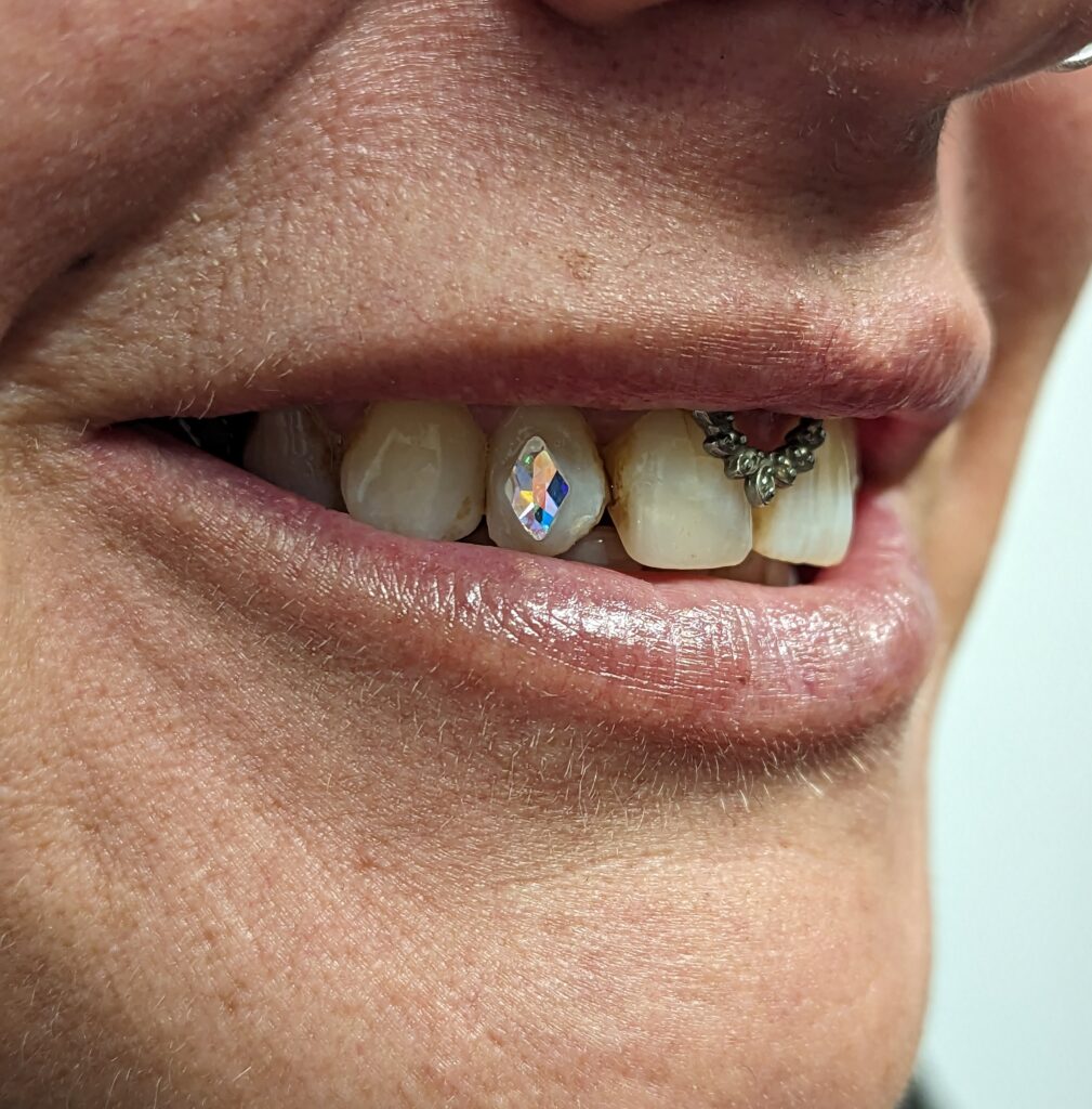  1 Set sweet smile gems teeth gems decor tooth gems for teeth  uptight white tooth polish mens tooth gem crystal tooth gems teeth jewelry  teeth jewels compact plastic Pack man 